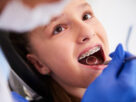 ściąganie aparatu ortodontycznego