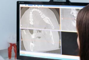 Ile trwa tomografia komputerowa zębów?
