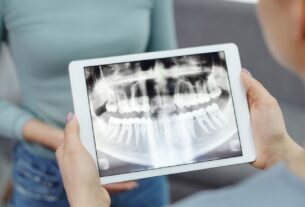 Czy RTG zęba można zrobić od razu podczas wizyty u dentysty?